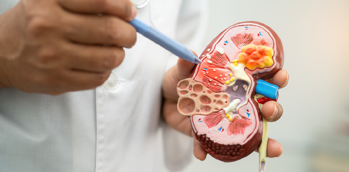 Chronic Kidney Disease